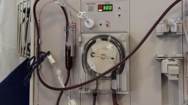 dialysis patients take calcium acetate